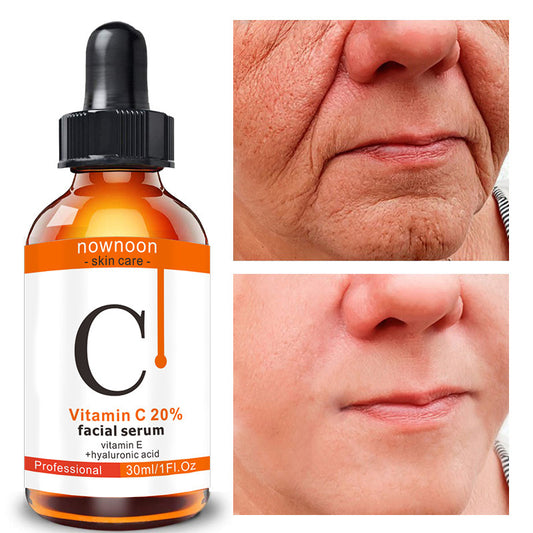 Sérum Visage à la Vitamine C – Éclat & Anti-Âge 30 ml